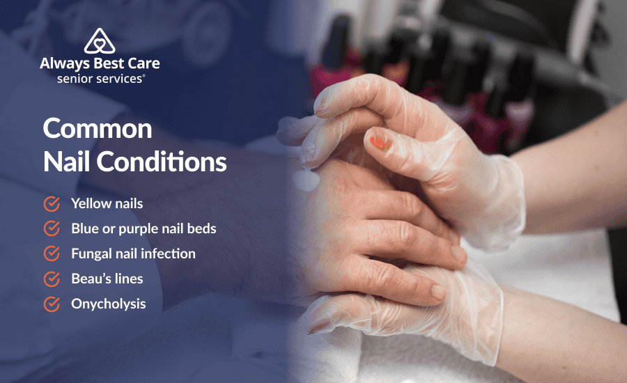 An infographic highlighting the nail conditions seniors often experience