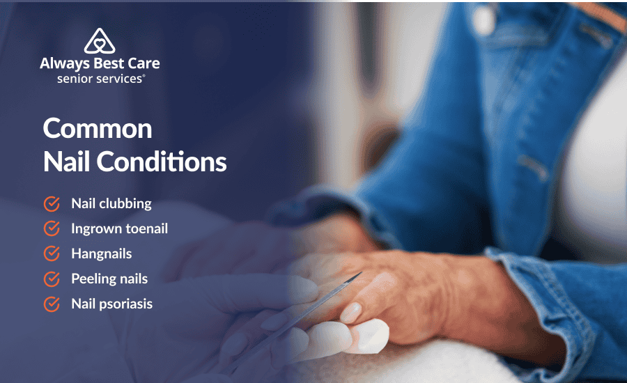 An infographic highlighting common nail conditions in the elderly